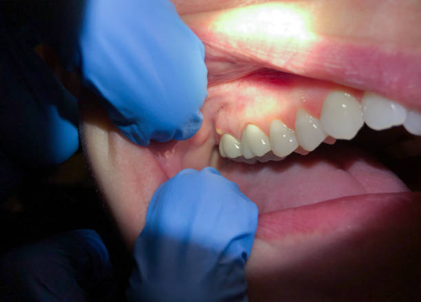 Best Emergency Cosmetic Dentistry (e.g., broken veneers) in Baxter Estates, NY