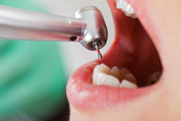 Best Dental Abscess Treatment in Baxter Estates, NY